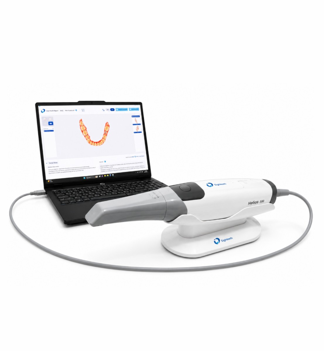 Dental 3D scanner