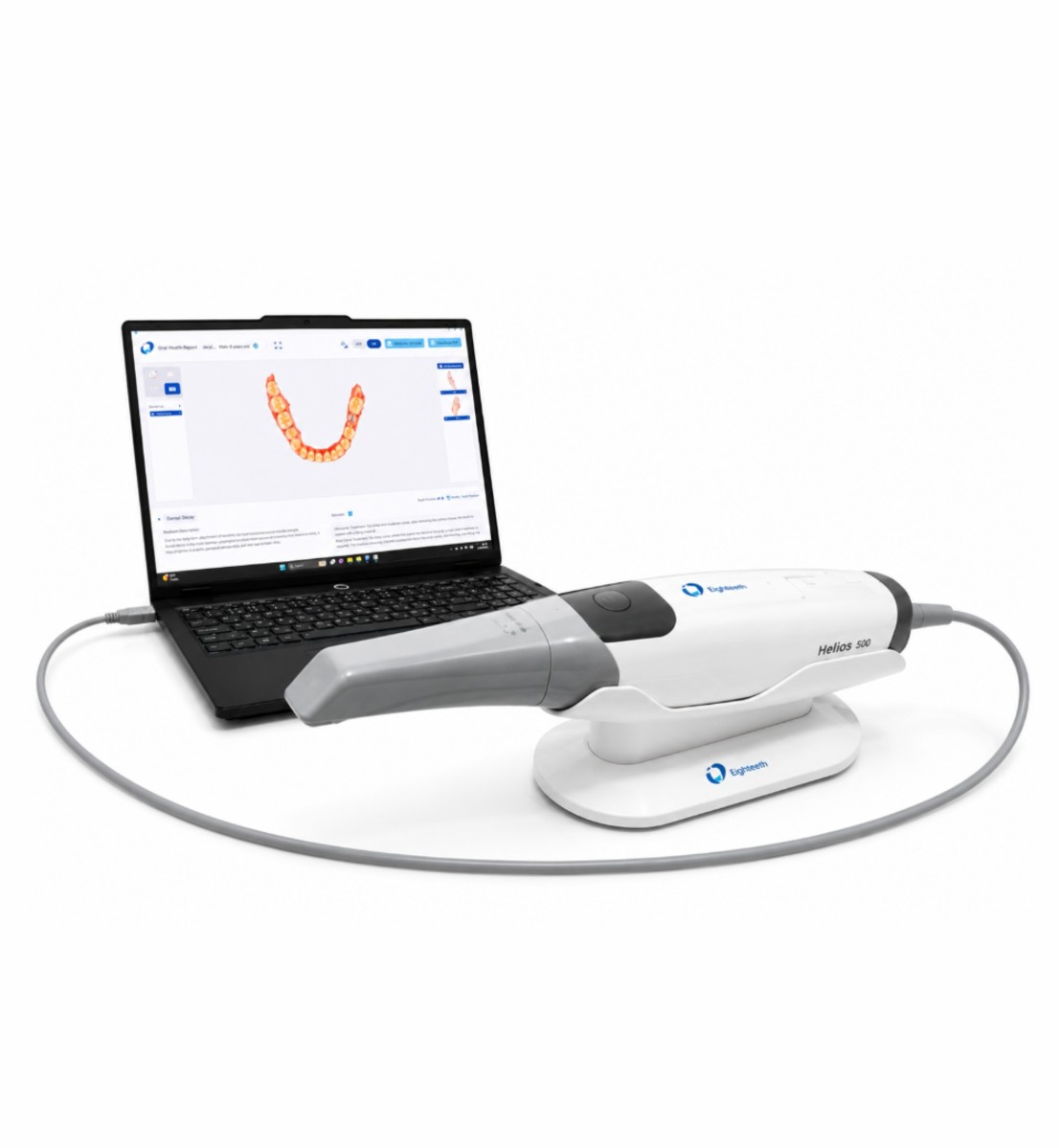 Dental 3D scanner