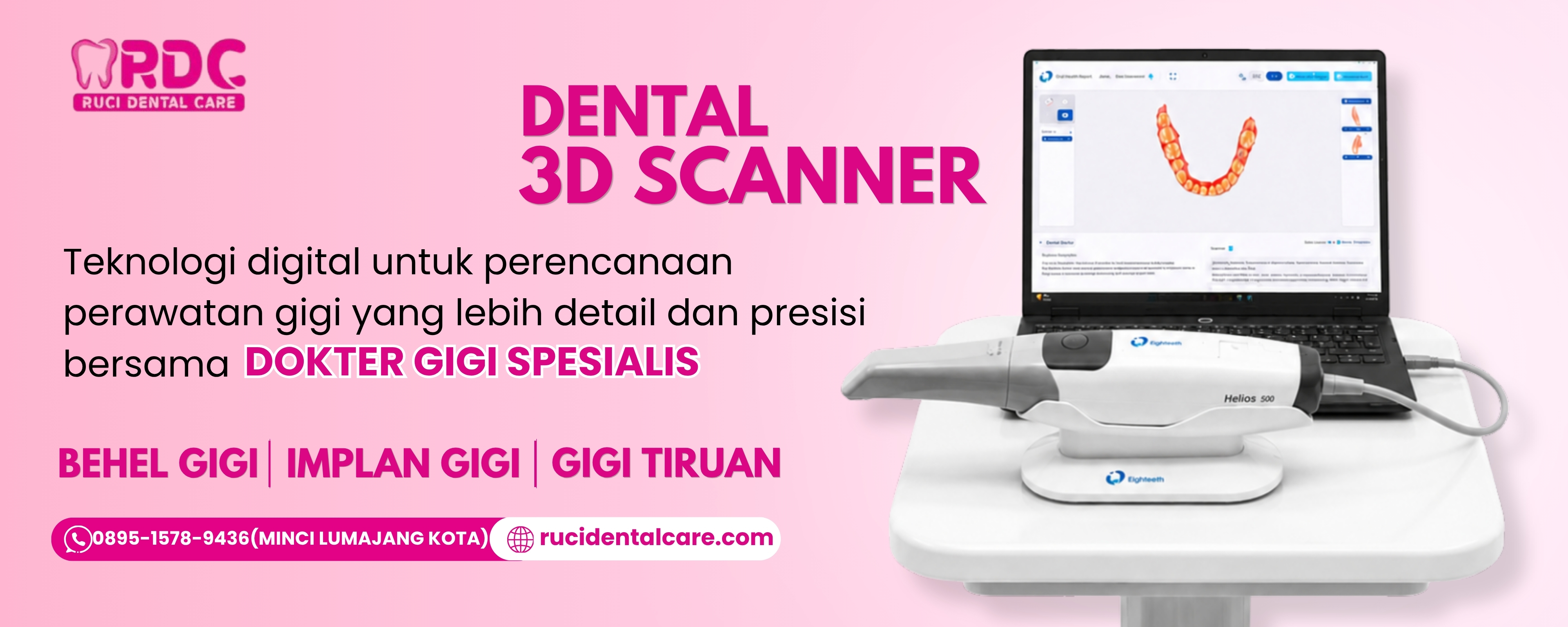 RASAKAN TEKNOLOGI DIGITAL YANG LEBIH DETAIL DAN PRESISI BERSAMA DOKTER GIGI SPESIALIS